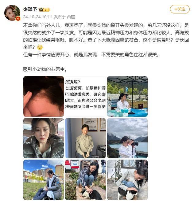 女星张馨予回应斑秃：好多了